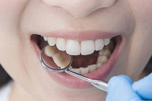 Comprehensive Dental Services in Oakville for All Your Needs 5 Hygiene