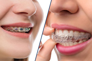 Comprehensive Dental Services in Oakville for All Your Needs 3 Invisalign and braces