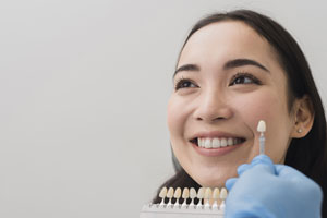 Comprehensive Dental Services in Oakville for All Your Needs 4 Veneers