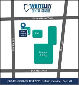 Contact White Lily Dental in Oakville Today 1 Map whitelily 1