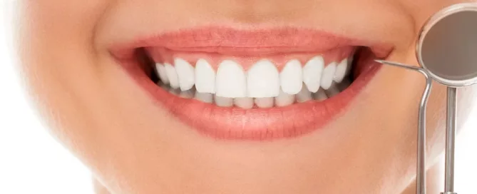Teeth Whitening