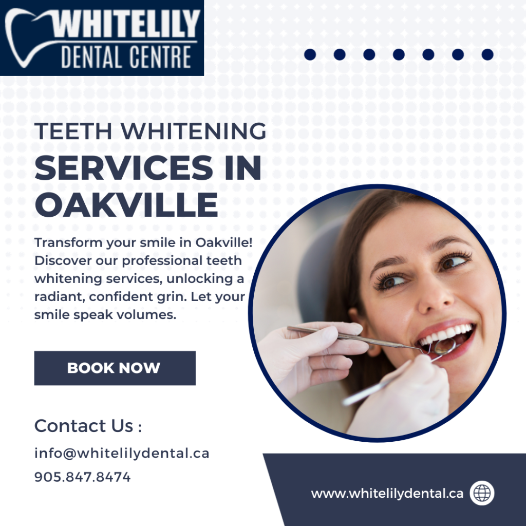 Teeth Whitening Service