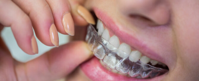 Invisalign in Oakville, ON