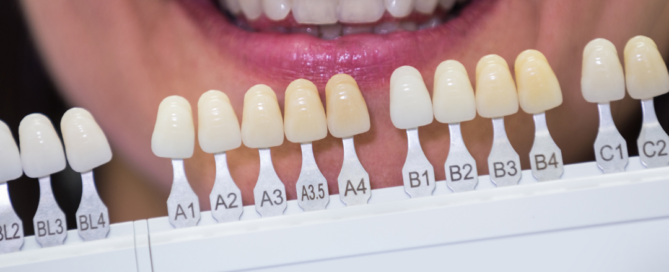 Teeth Whitening