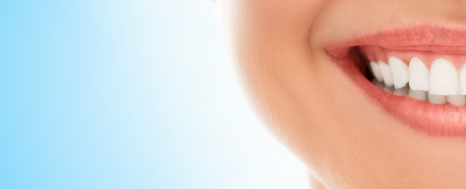 teeth whitening