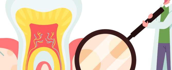Root canal