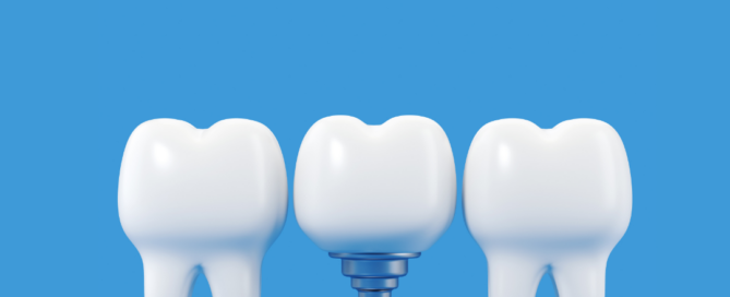 Dental implants in Oakville, ON