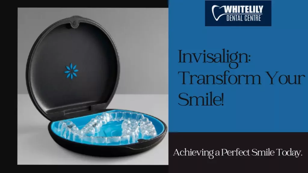 Invisalign in Oakville Transform Your Smile!