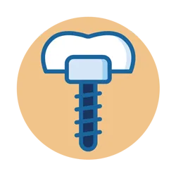 Dental Implant1