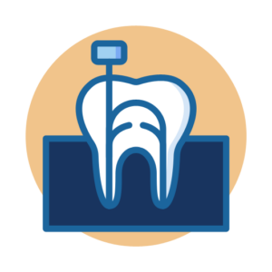 Root Canal1 1