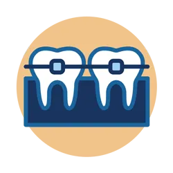 braces1