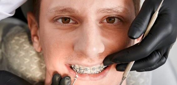 The Science of Straight Teeth: Solving Alignment Issues with Orthodontics in Oakville 3 Orthodontics in Oakville