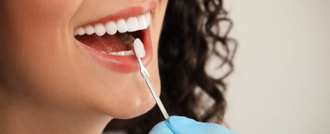 Reliable Dental Implants in Oakville ON