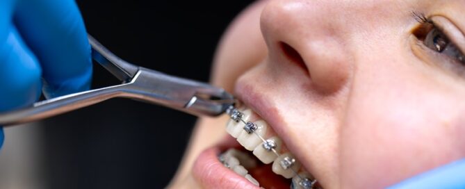 Top Dental Services in Oakville, ON: Orthodontics, Dental Implants & More 1 Dental Implants in Oakville ON