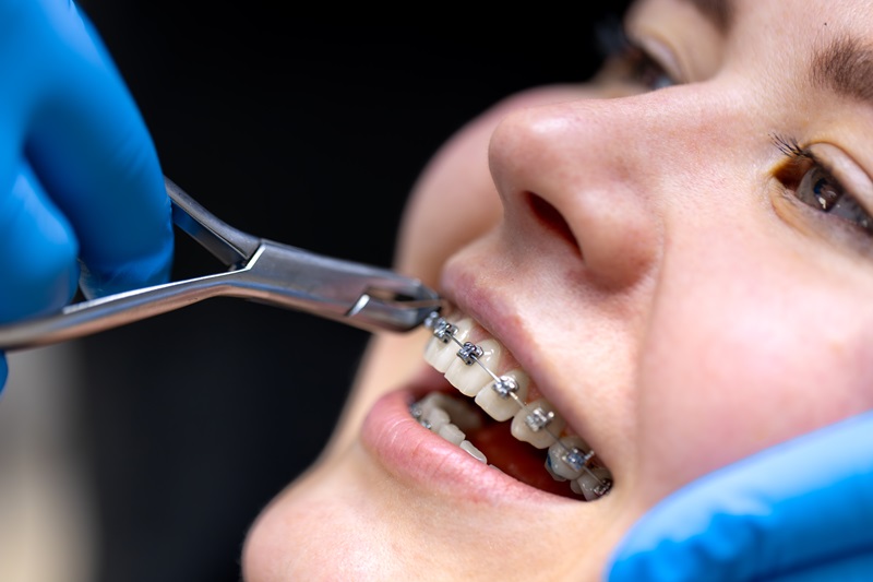 Dental Implants in Oakville ON