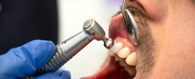 Hygiene Therapy & Dental Cleaning in Oakville, ON 2 Preventive dental care in Oakville ON