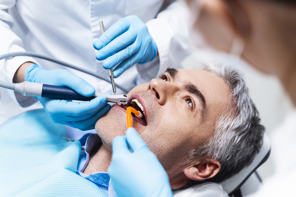 Root Canal Treatment in Oakville